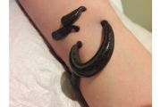 Blutegeltherapie am Arm