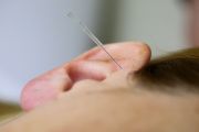 Ohrakupunktur - Ganzheitliche Medizin Düsseldorf